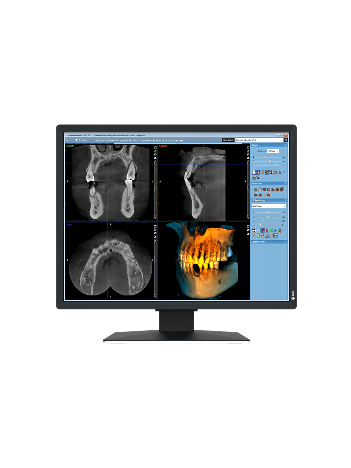 21" EIZO RadiForce MX217-SB - 1200x1600 - IPS