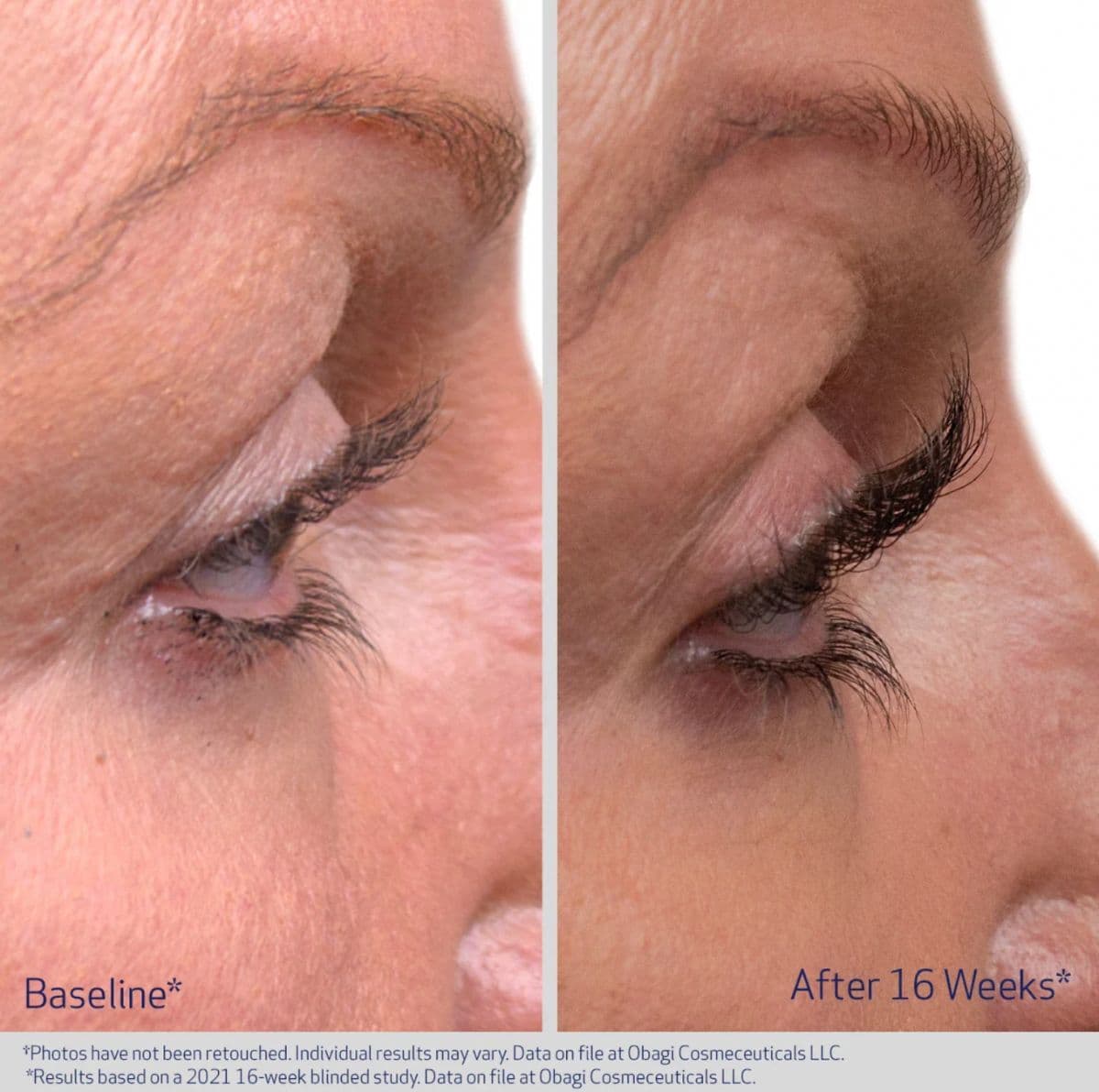 Obagi Medical Obagi Nu-Cil Eyelash Enhancing Serum 3ml
