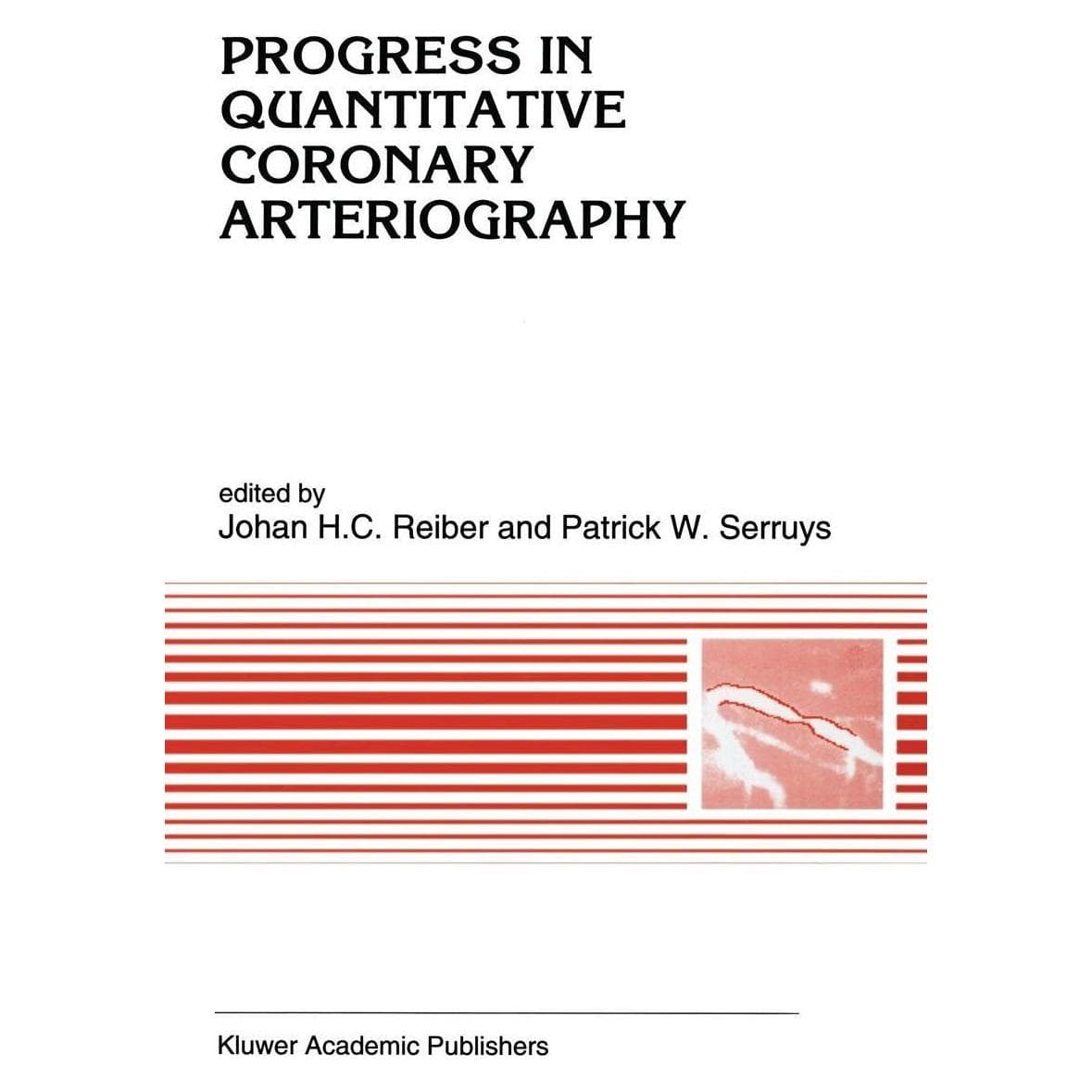 Springer Progress in quantitative coronary arteriography (Englisch, Hardcover, Johan H. C. Reiber, Patrick W. Serruys) (9780792328148)